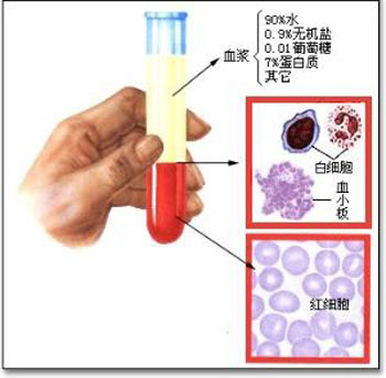 紅細(xì)胞變形性異常與相關(guān)疾病