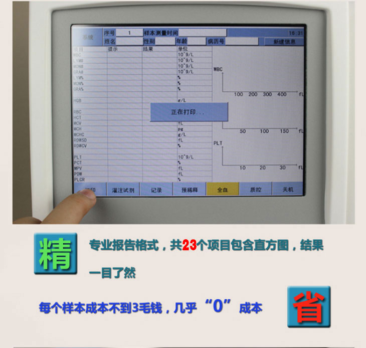 血液分析儀細節(jié)圖