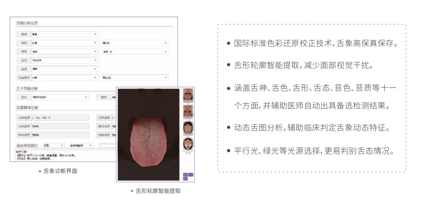 中醫(yī)舌診儀（舌象信息采集管理系統）MT-SX-02舌象分析特點.png